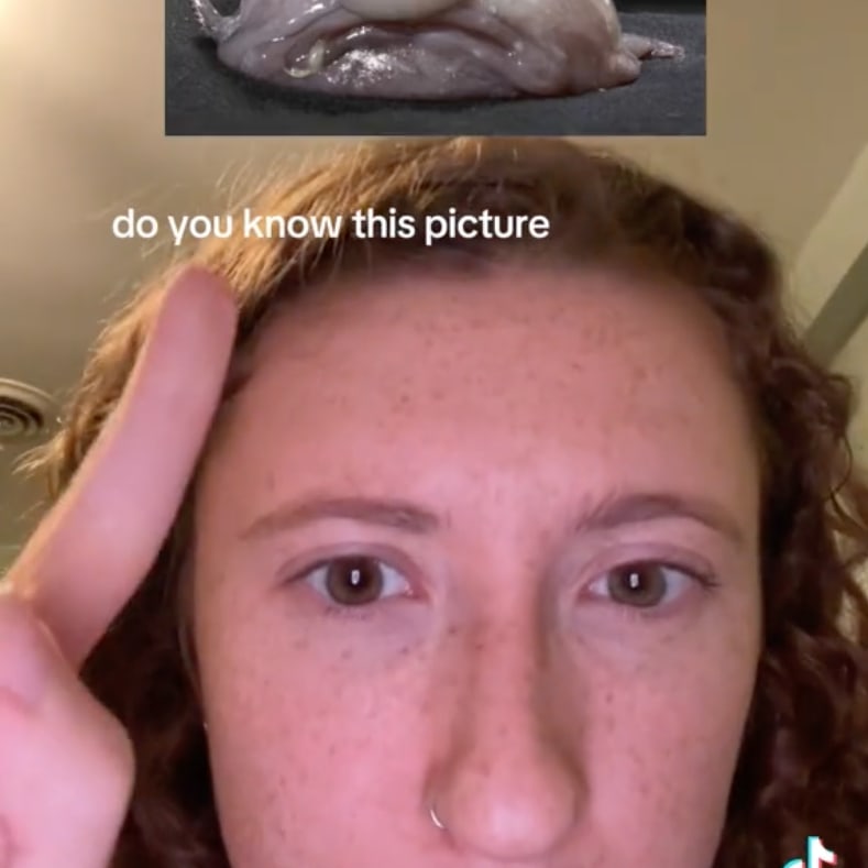 TikTok Wants You To Know That Blobfish Are Not Actually Ugly